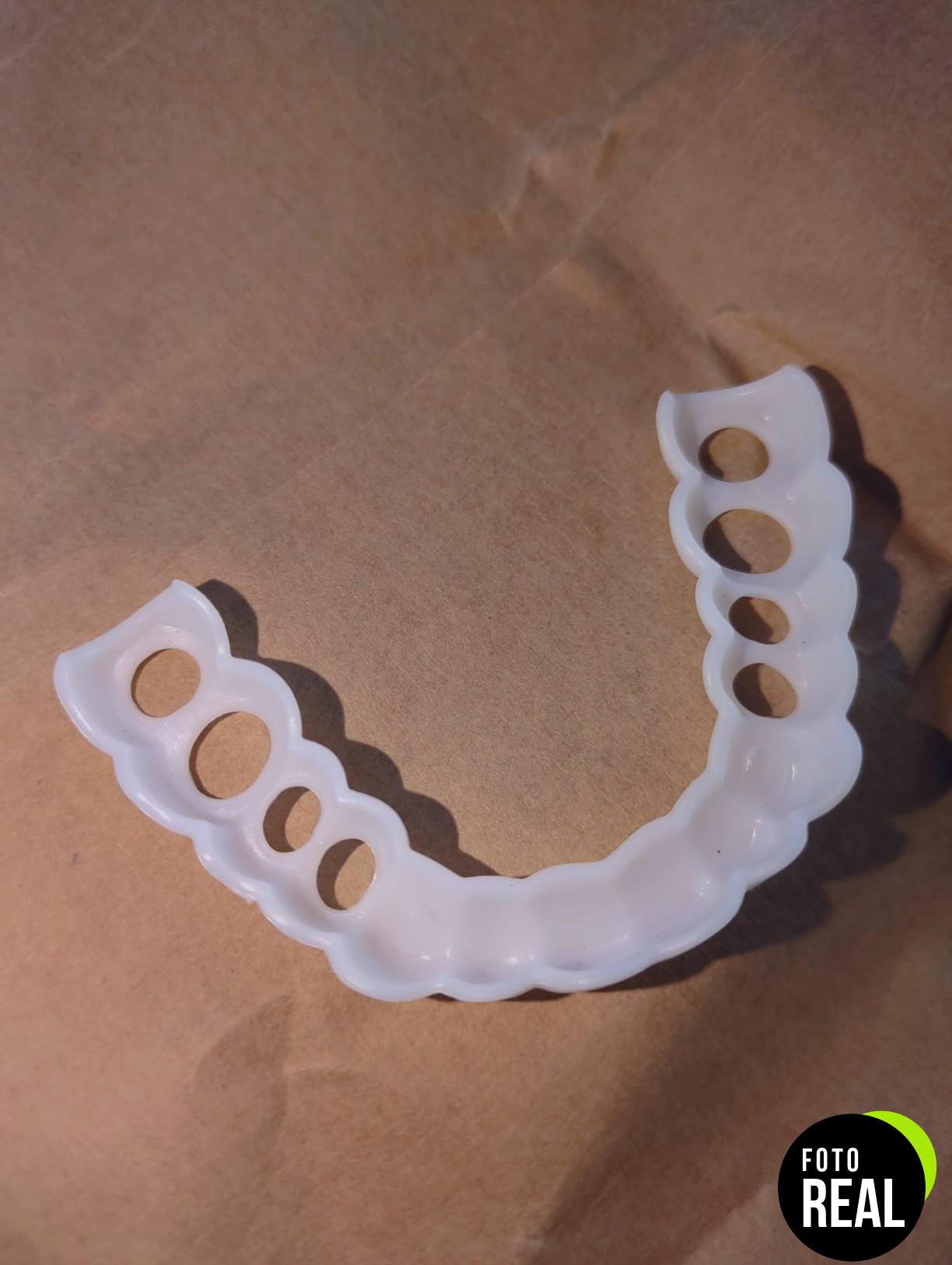 carillas-cosmeticas-dentales-3-pares-foto-1