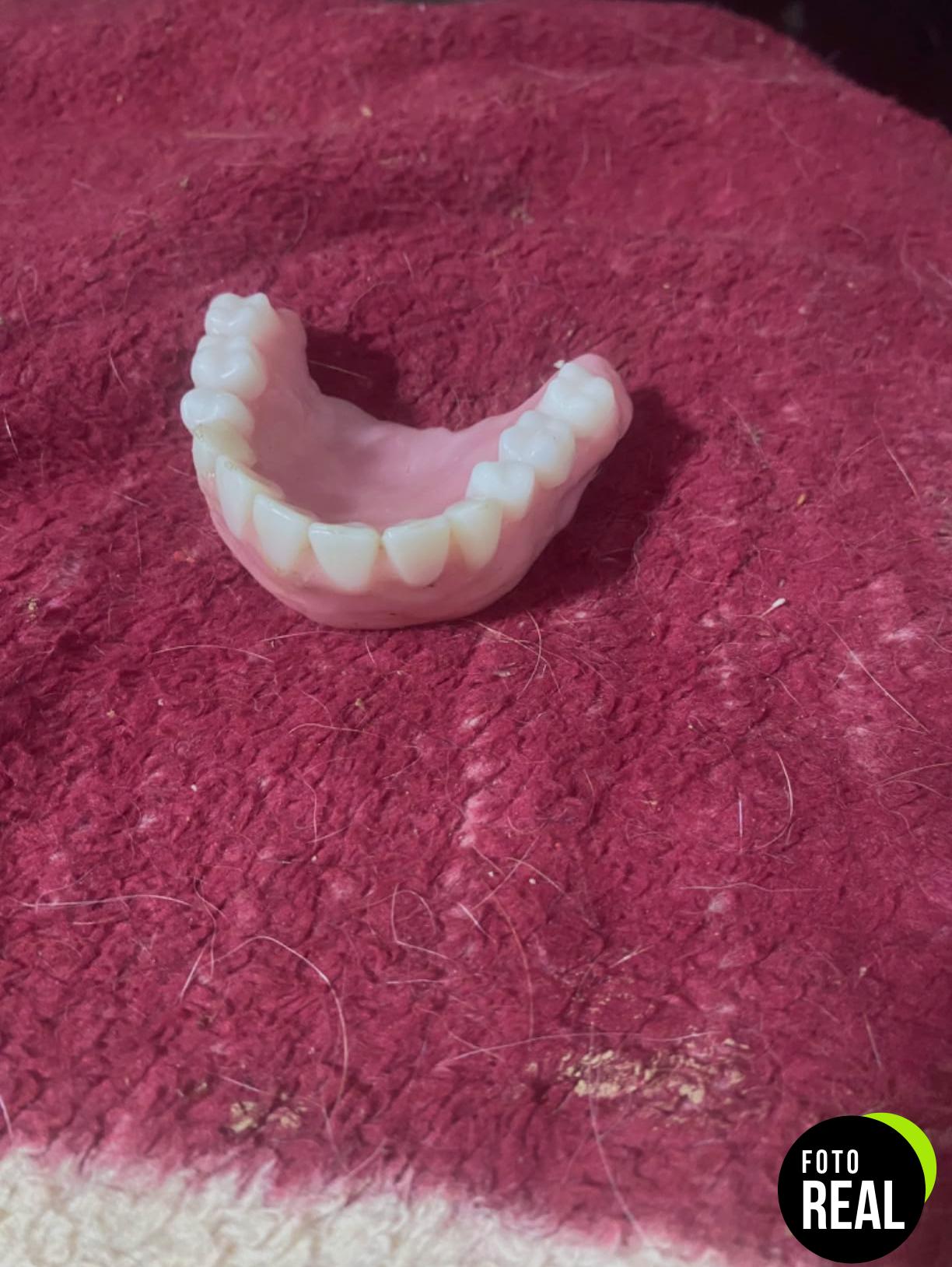 corona-dientes-kit-2-foto-2