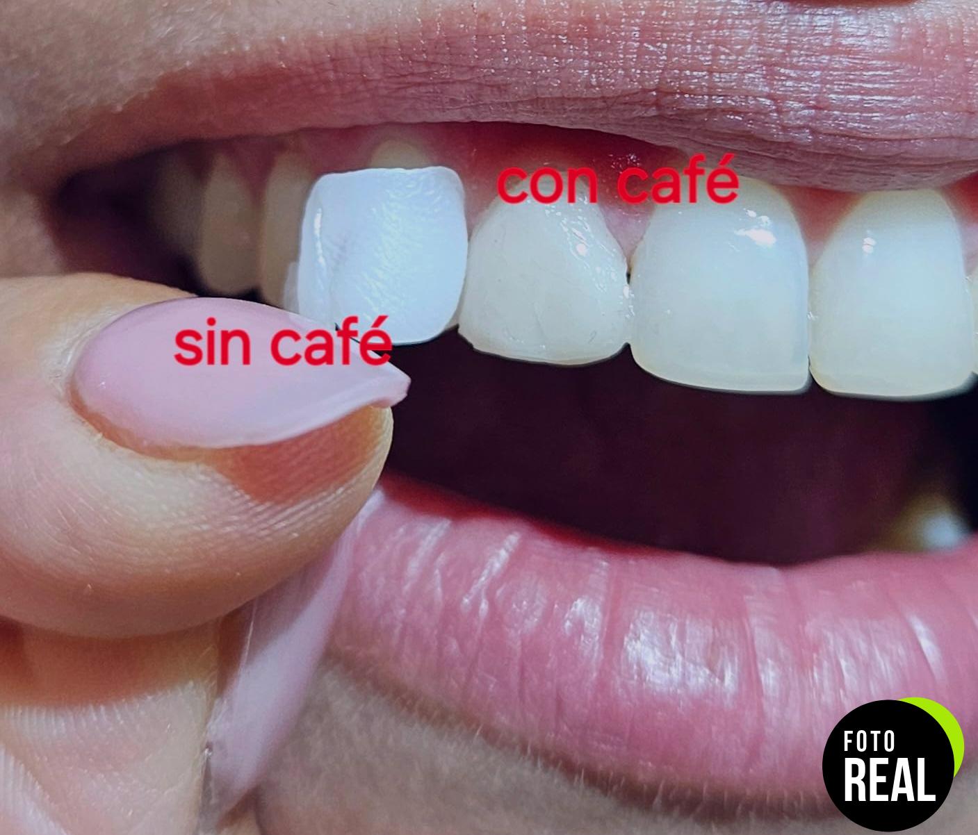 creadent-kit-diente-cosmetico-blanco-foto-1
