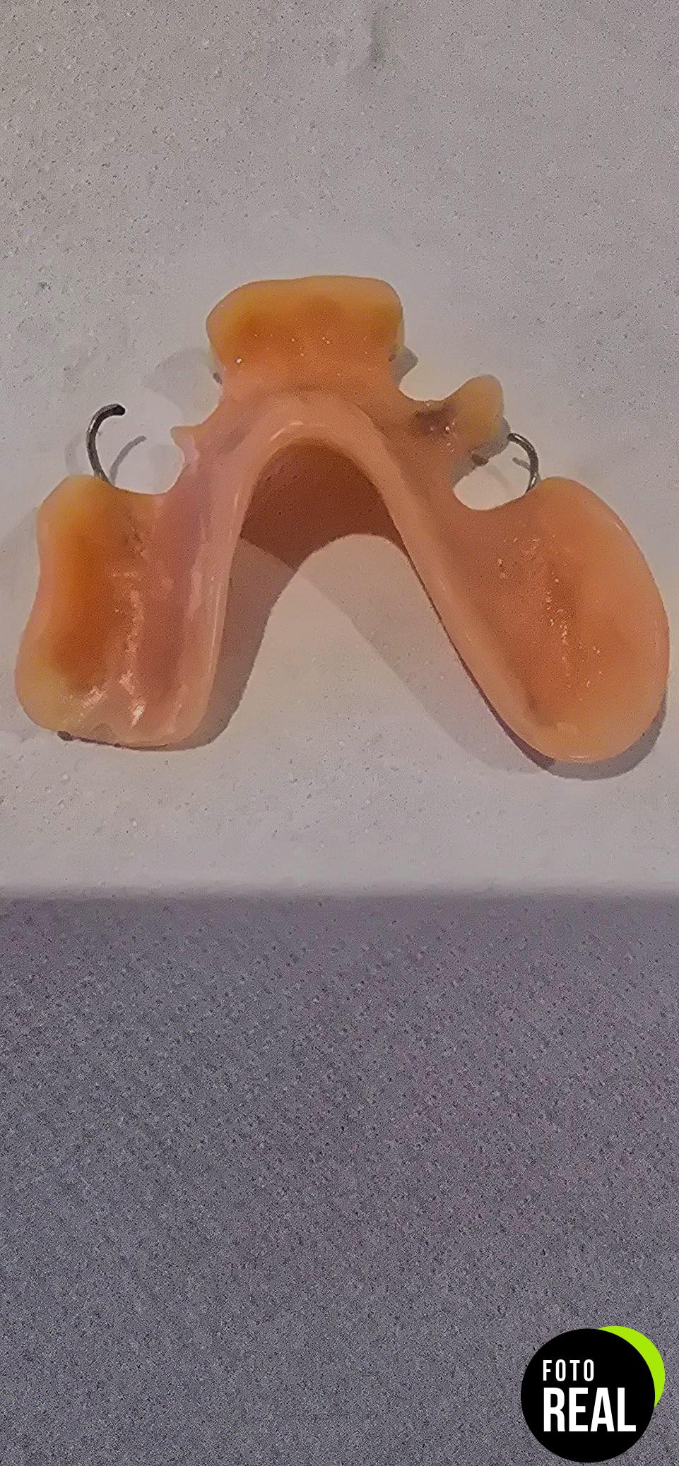 mono-reparador-dentaduras-foto-1