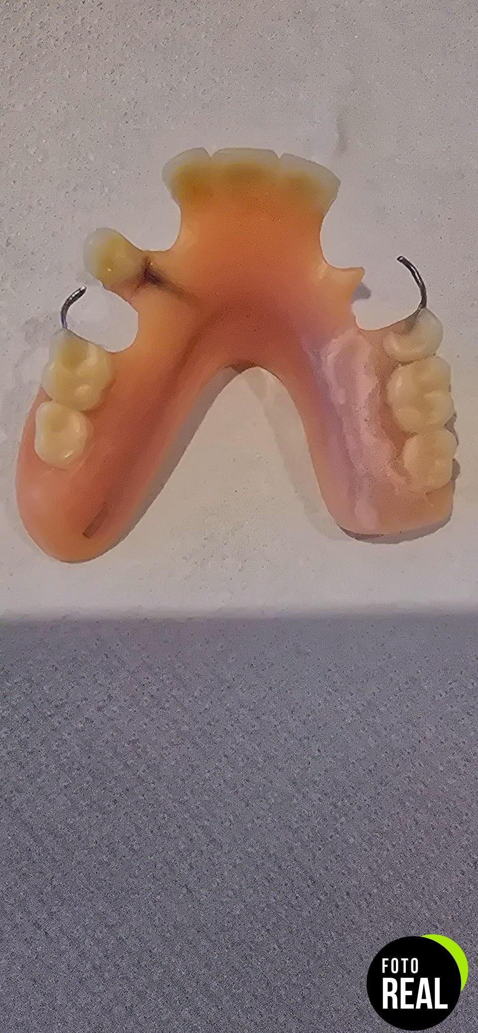 mono-reparador-dentaduras-foto-2