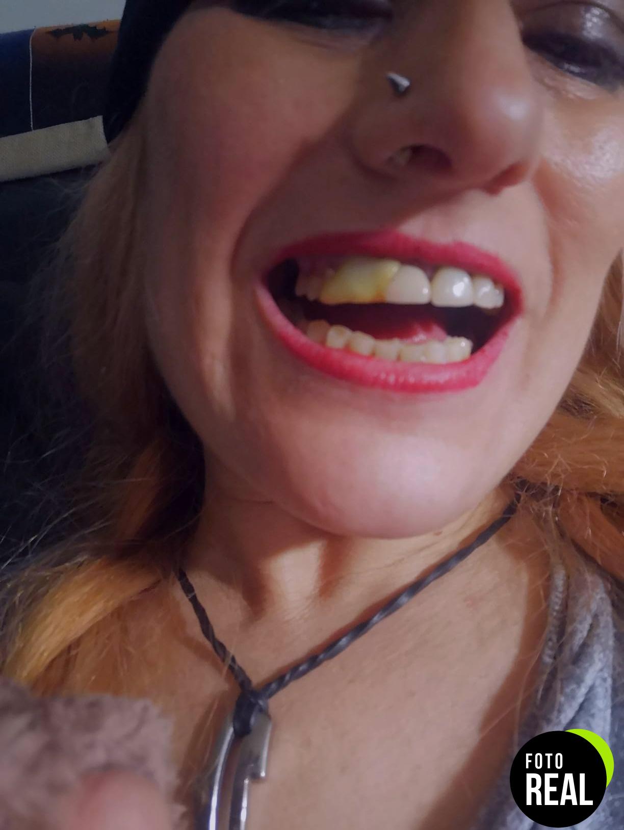 perla-dental-dientes-falsos-50g-foto-3